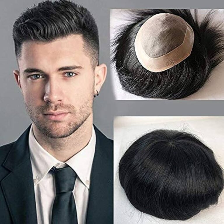 Top Advanced Hair Patch in South Delhi