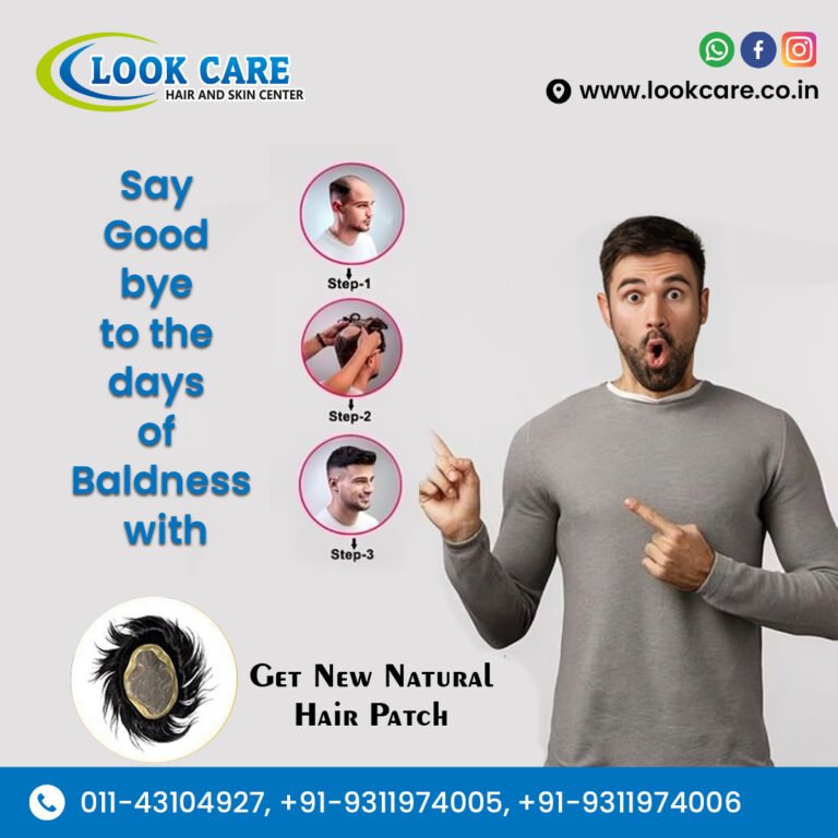 Men Hair Replacement