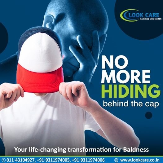 Unlock Confidence with Hair Patch Solutions