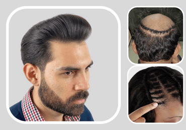 Hair Patch Near Me