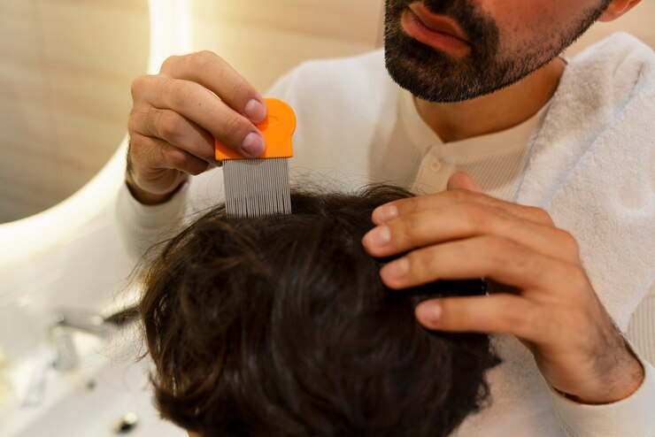 Best Hair Replacement Service in Lajpat Nagar