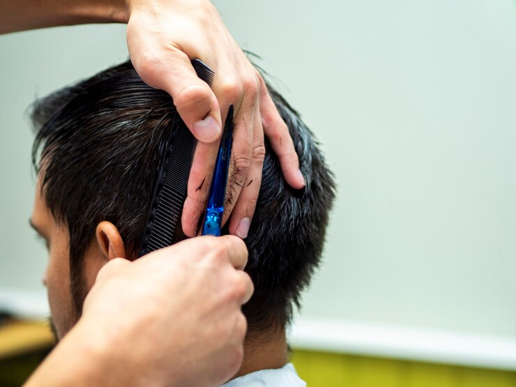 Best Permanent hair patch service in Lajpat Nagar